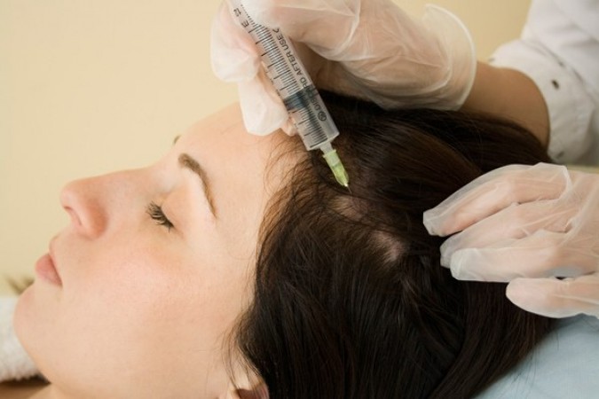 Beat hair loss with Platelet-Rich Plasma therapy